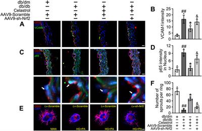 Celastrol alleviates diabetic vascular injury via Keap1/Nrf2-mediated anti-inflammation